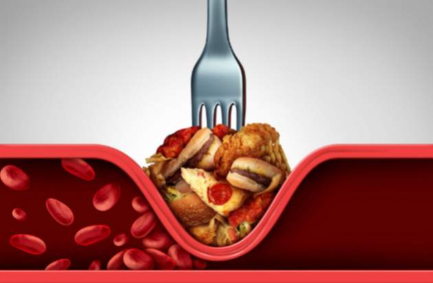 Vysoký cholesterol Vysoký cholesterol