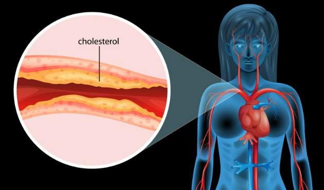 Zlý cholesterol Zlý cholesterol