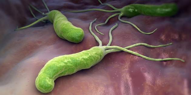 Helikobakter - Helicobacter pylori Helikobakter - Helicobacter pylori