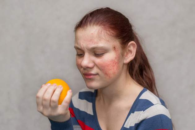 Alergia a vyrážky Alergia a vyrážky