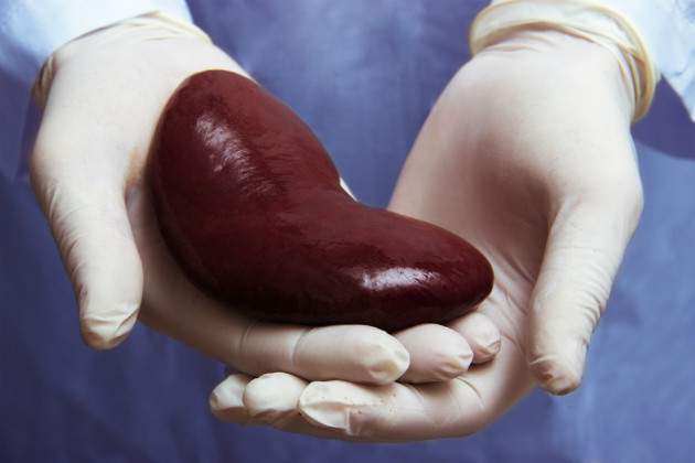 Transplantácie Transplantácie
