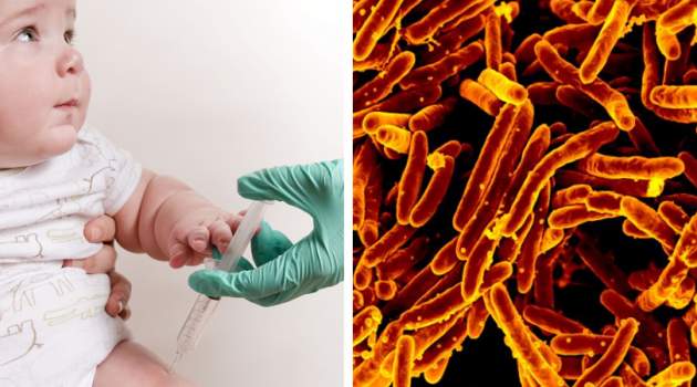 nová vakcína proti tuberkulóze nová vakcína proti tuberkulóze
