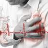 Infarkt myokardu - srdcový infarkt