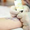 Klik-Klinik pomáha: Zápal po tetovaní