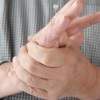 Aké sú príčiny brnenia v rukách, nohách či v tvári?