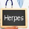 Genitálny herpes