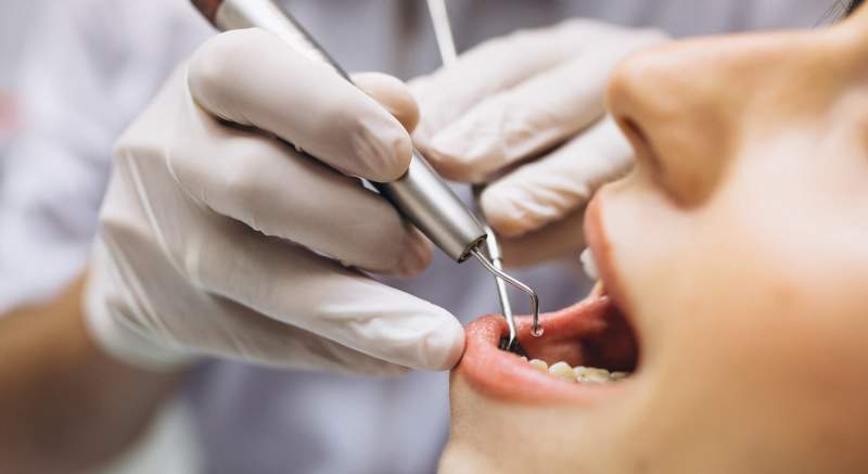 Zrušenie zubných benefitov v zdravotných poisťovniach zo dňa na deň kritizuje aj Slovenská komora zubných lekárov